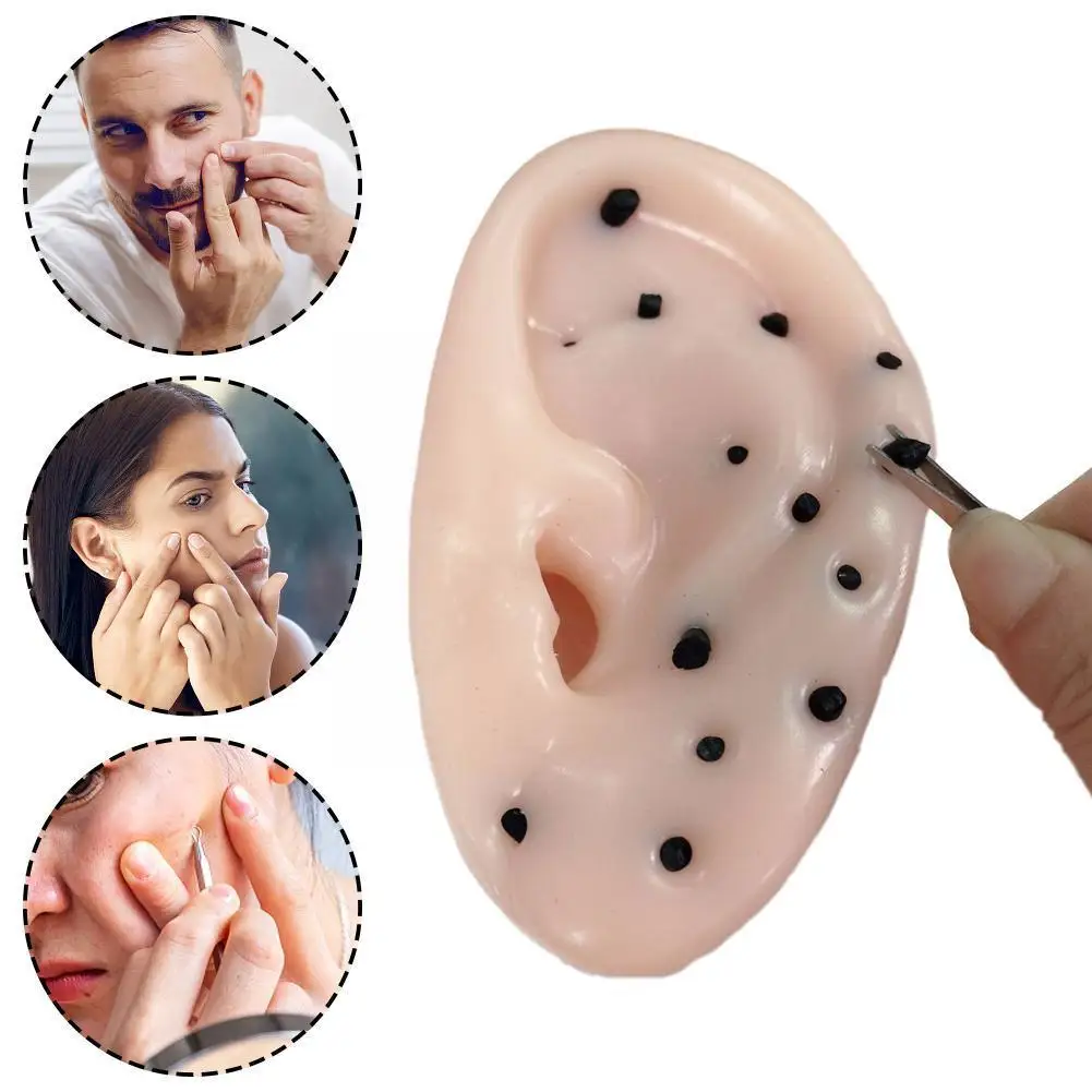 

Pimple Popper Toys Ears Shaped Pimple Popping Decompression Toy Fun Blackheads Acne Remover D4c1