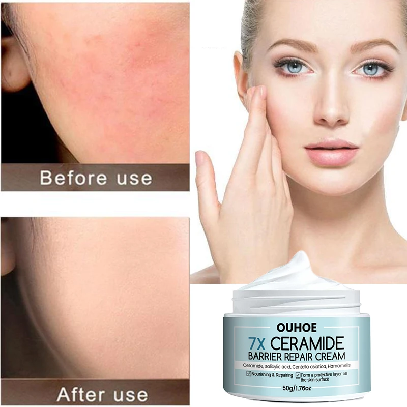 

Омолаживающий крем для лица, восстанавливающий питательный крем для гладкой кожи, уменьшает покраснение, сухость, увлажнение, отбеливание, Корейская продукция по уходу за кожей 50 г