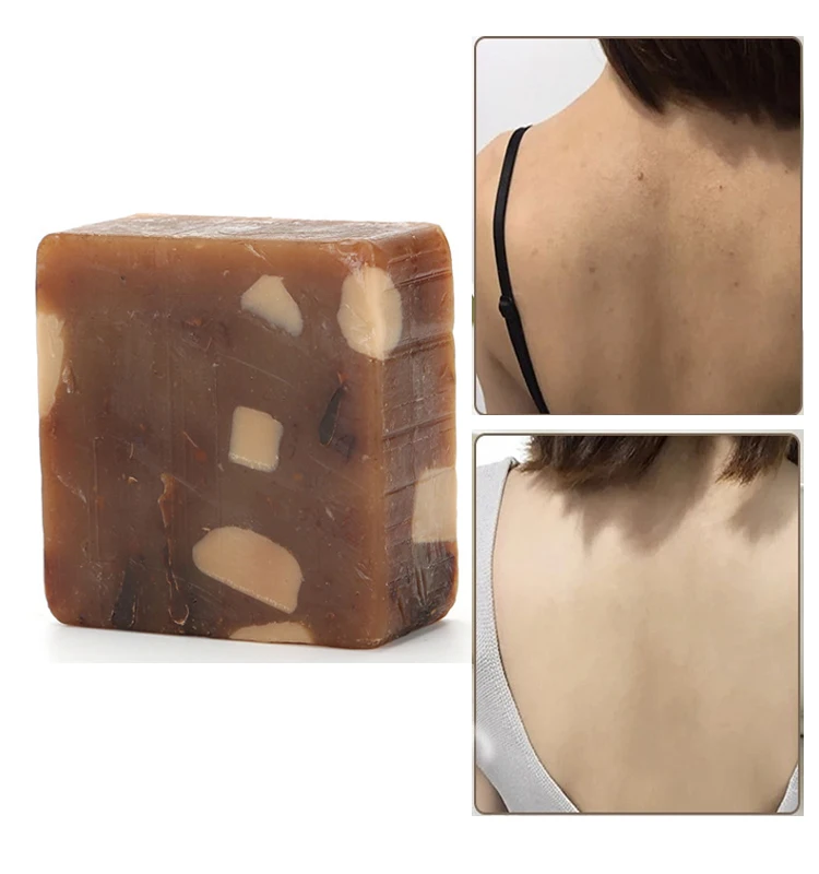 

Natural 100% African Black Soap Anti Taches Rebelles Beauty Bath Body Treatment Acne Skin Care Handmade Soap