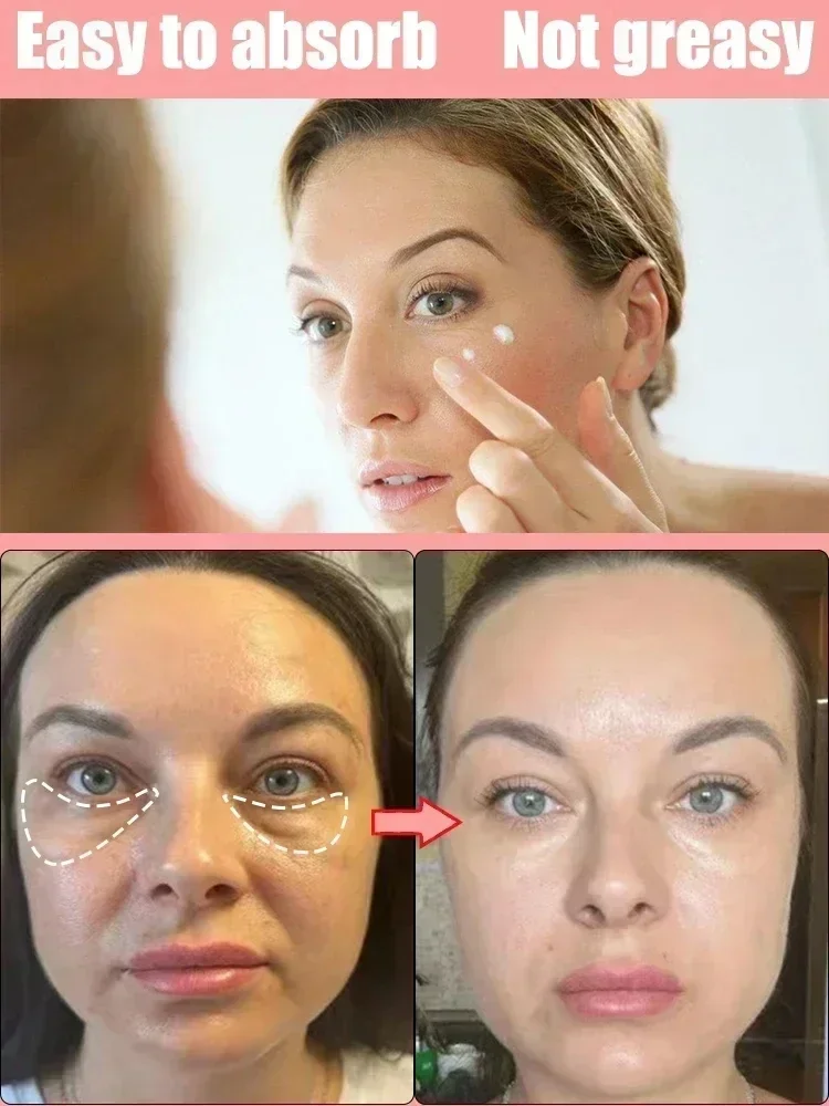 Крем для глаз против темных кругов VC отбеливающая осветляющая фотоблестящая