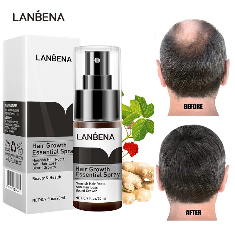 

LANBENA New Hair Growth Essence Spray Prevent Hair Loss Nourishing Scalp Hair Root Ginger Extract Treat Damaged Hair Conditioner