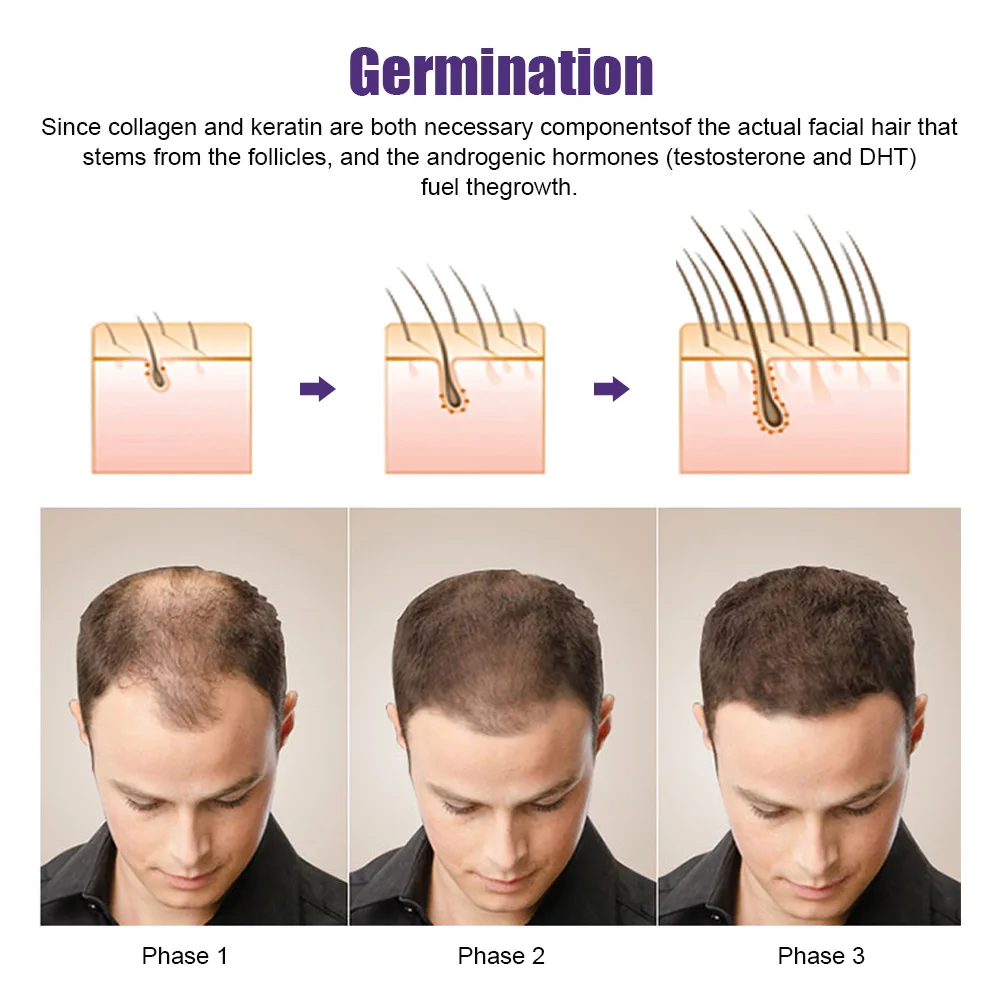 Фото Derma Microneedling микроигла микроиглы ролик для лица для роста волос Dermastamp уход за кожей мезотерапия красота дропшиппинг №4