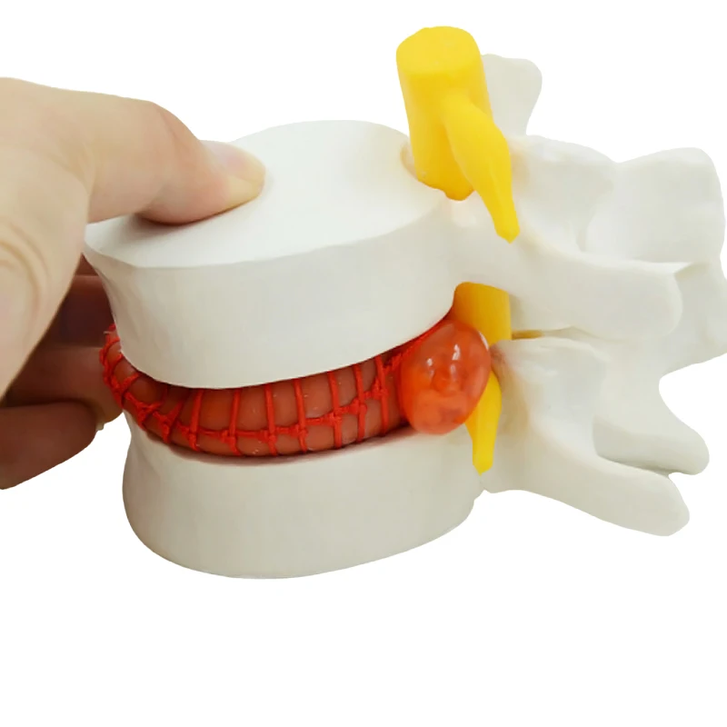 

Анатомическая модель позвоночника DARHMMY