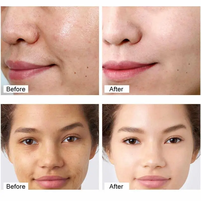 Рисунок 5 - Увлажняющий крем для лица