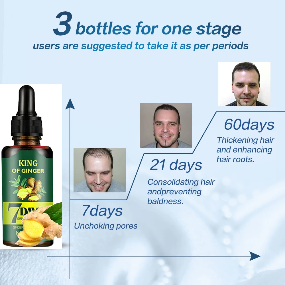 Сыворотка для роста волос Ginger эфирное масло Питательная Жидкость смягчения и