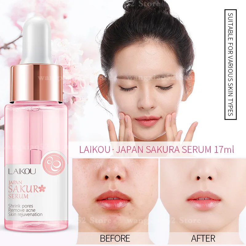 

Genuine facial essence cherry blossom moisturizing skin care products toner soothes skin to improve dry rough skin unisex 17ml