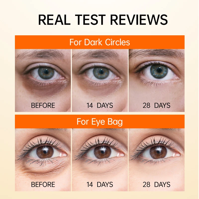 Рисунок 6 - Увлажняющий отбеливающий крем для кожи вокруг глаз