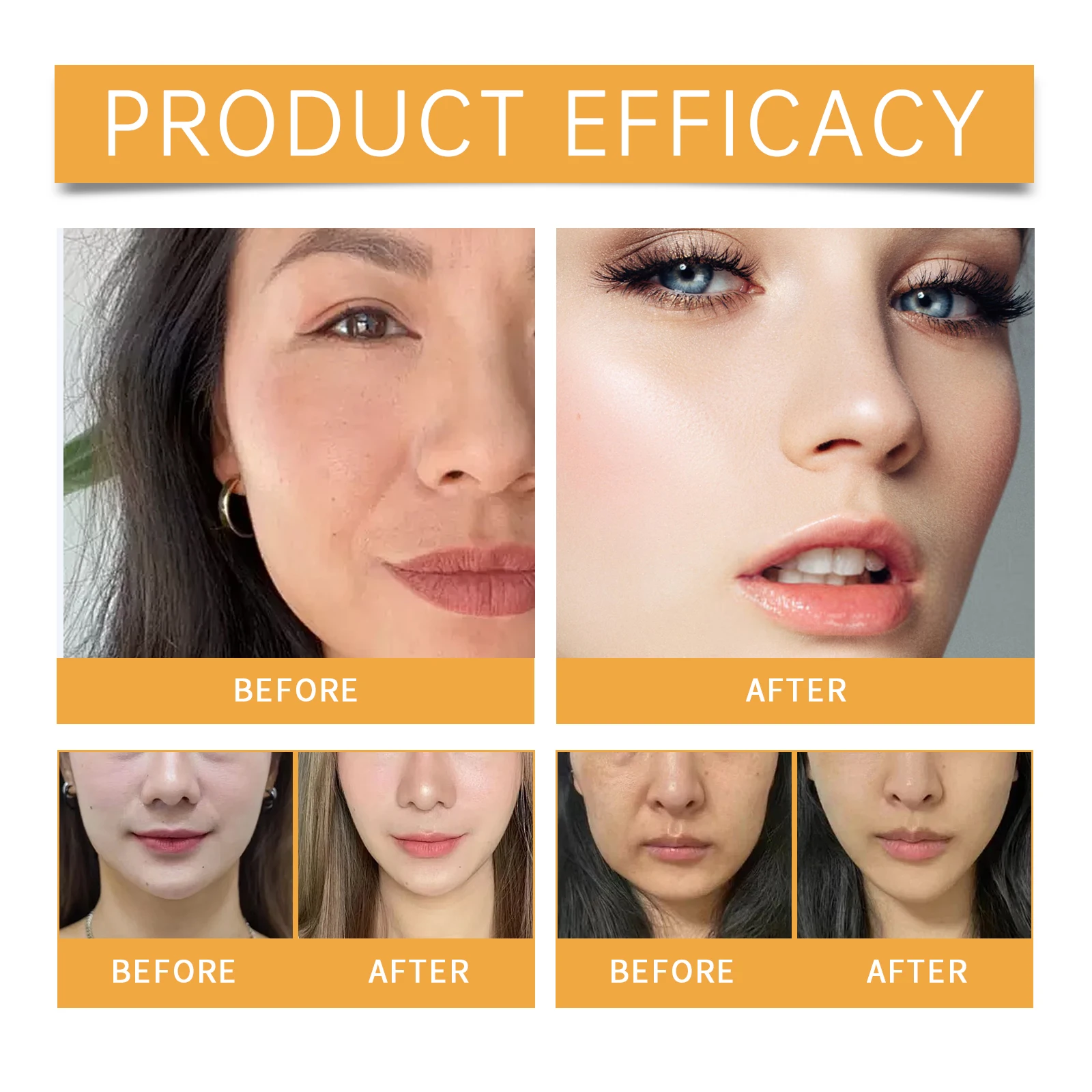 Фото Пластырь со складками на носогу содержит коллагеновую гиалуроновую кислоту, укрепляющий кожу, выцветает тонких линий, глубоко увлажняющая маска для лица против морщинA №2