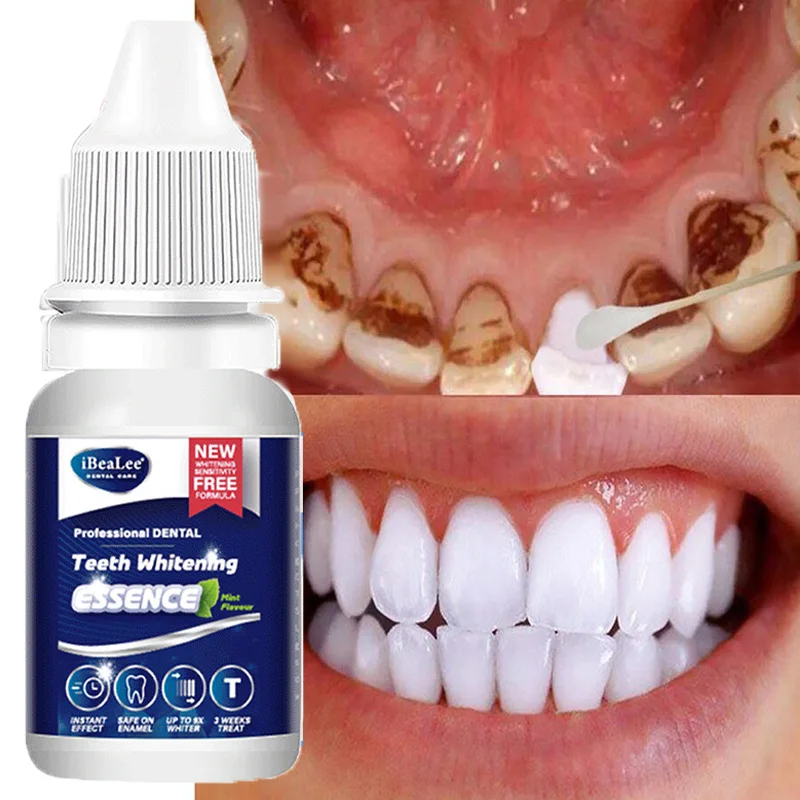 Teeth Whitening Essence Serum Remove Plaque Stains Oral Hygiene Cleaning Fresh Breath Dental Bleaching Products Tooth Care Tools