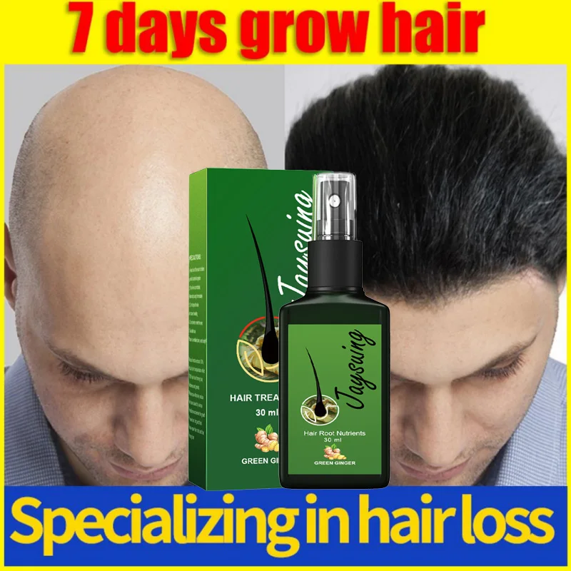 10pcs Ginger Hair Growth Spray Anti Hair Loss Serum Liquid Fast Grow Prevent Baldness Men Women Hair Care Korean Products 30ml