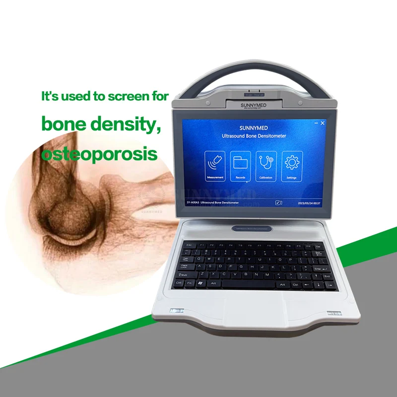 SY-A00A3 Portatil Escaner de densidad для клинической машины Densitometro oseo por ultrasonido