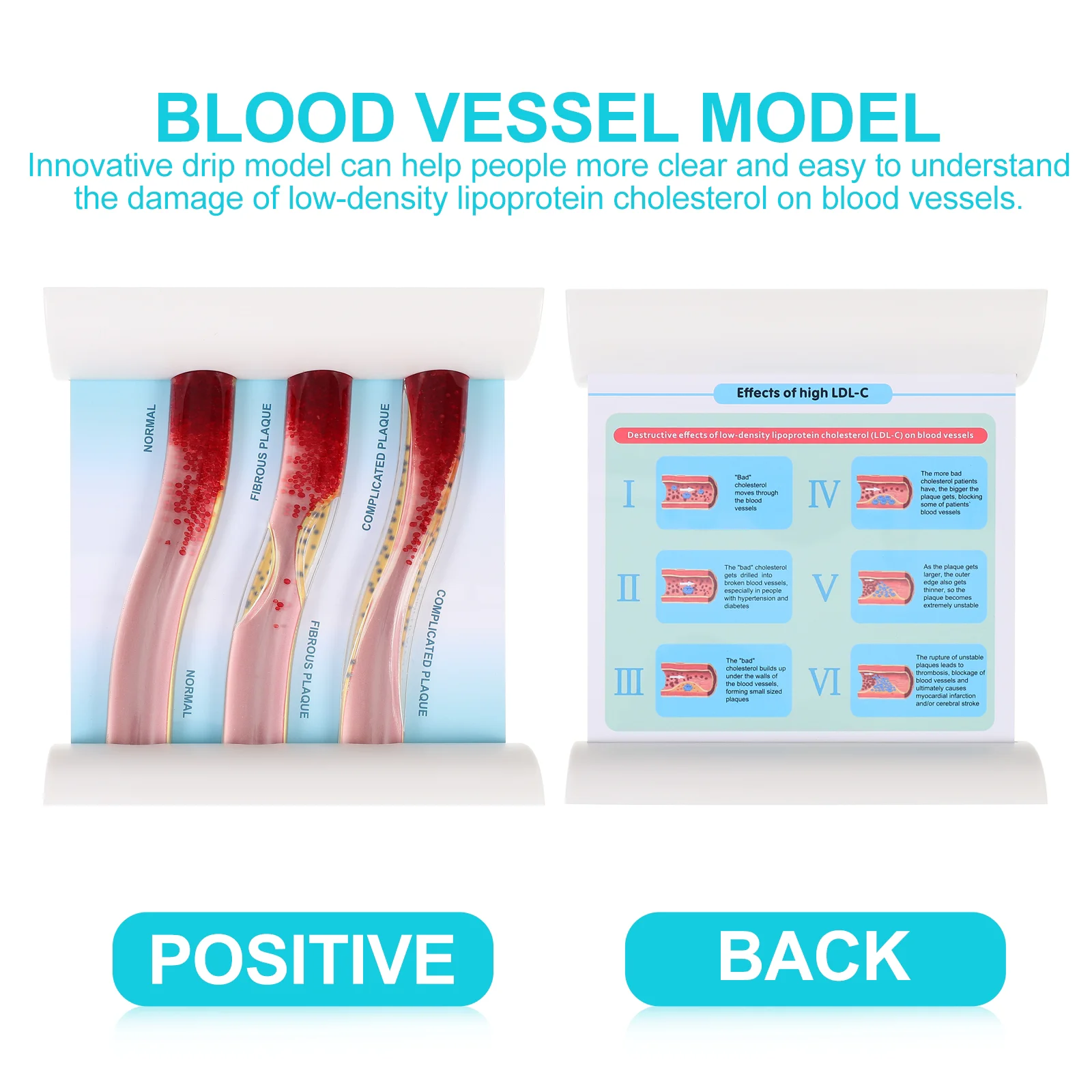 Рисунок 6 - Динамическая модель кровяного липида