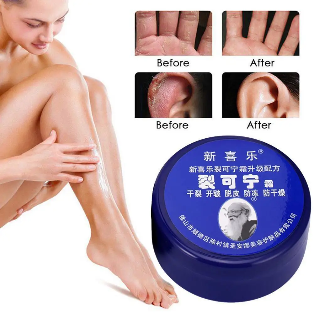 

Antifreeze Emollient Ointment Crack Foot Cream Anti-Drying Heel Cracked Repair Chilblain Cream Removal Dead Skin Hand Feet Care