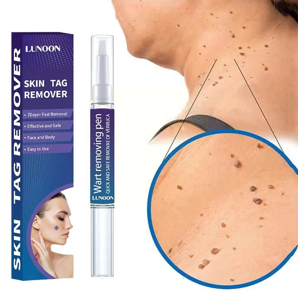 

Keyu жидкая ручка Keyu для удаления мозолей, мяса, гранул, плоский крем, Осветляющий травяной крем Keyu, Подошвенный крем для удаления бородавок и ягод кожи K7V9