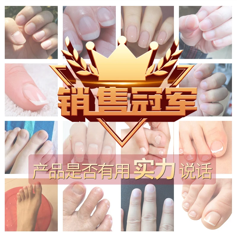 [Invalid] No Package Repair a Drop in the Morning and Evening Effect Is Very Good Fast Finger Toe |