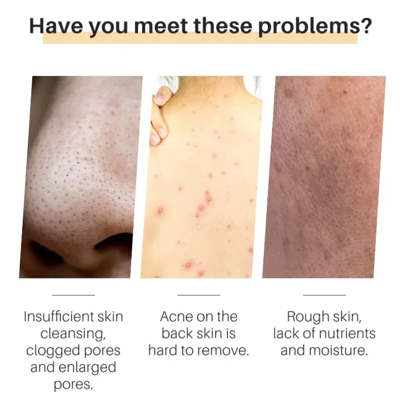 Рисунок 5 - Мыло с куркумой для очищения лица от акне