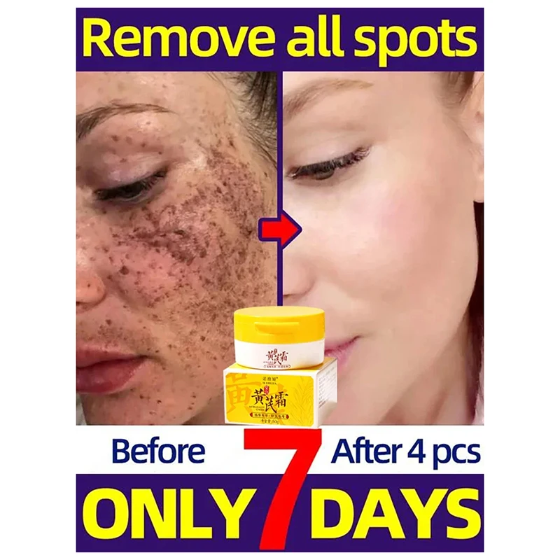 Эффективный отбеливающий крем для лица с астрагалом удаление темных пятен