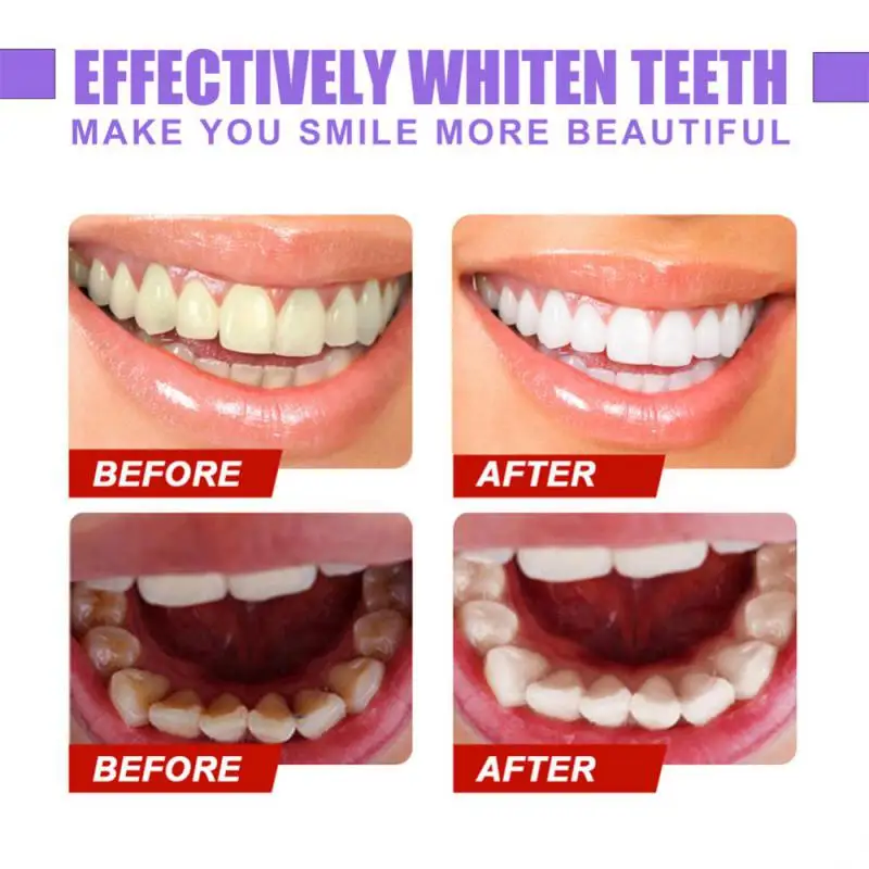 

Мусс для чистки зубов V34 в бутылке, фиолетовая зубная паста, освежитель дыхания, отбеливание пятен на зубах, удаление пятен, очищение зубов