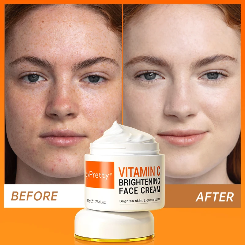 

Vitamin C Whitening Face Cream Dark Spots Remover Freckle Brightening Moisturizing Firming Facial Cream Beauty Health Skin Care