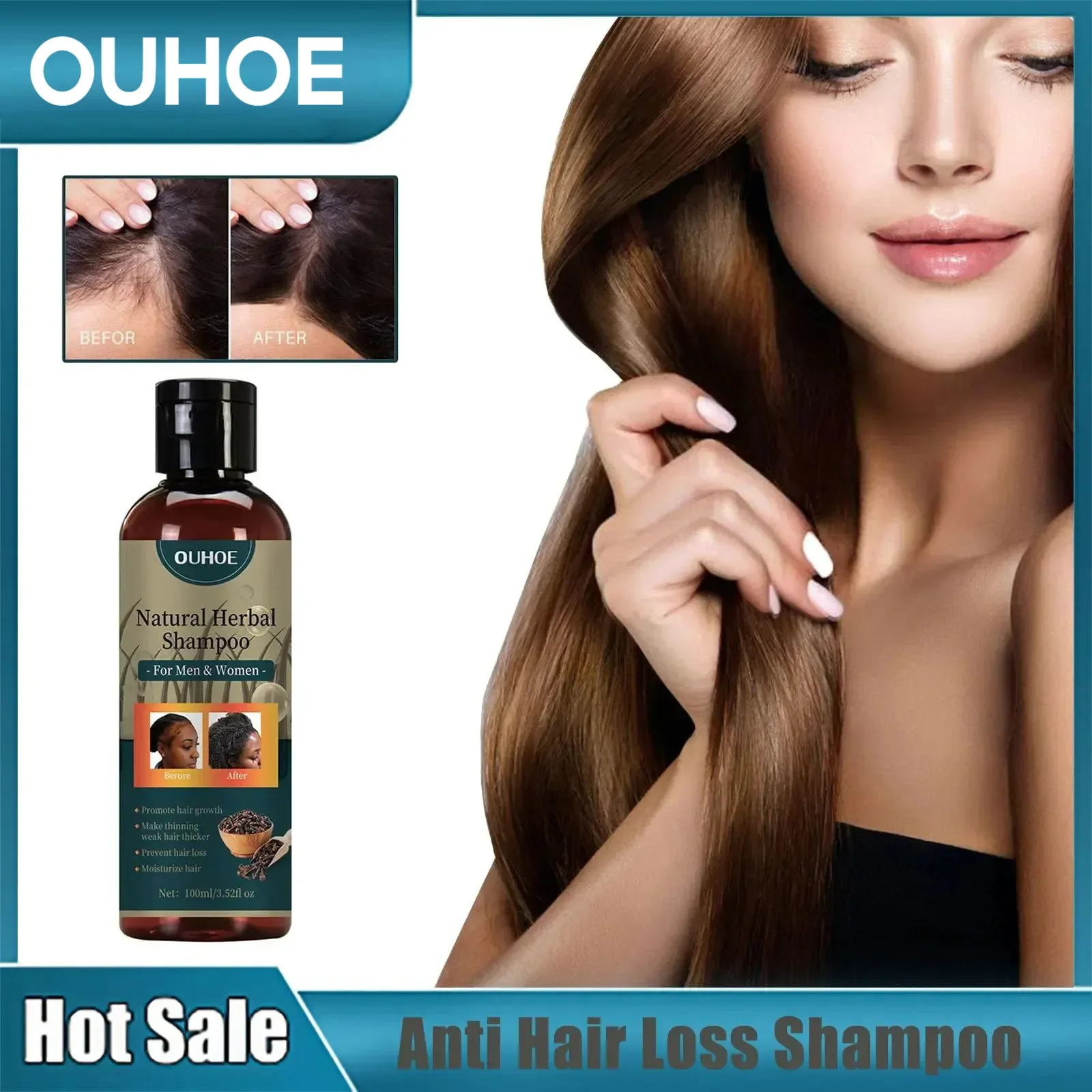 

Hair Growth Shampoo Hair Regrowth Prevent Loss Anti Alopecia Repair Follicle Relieve Dryness Curly Hydrating Thick Hair Shampoo