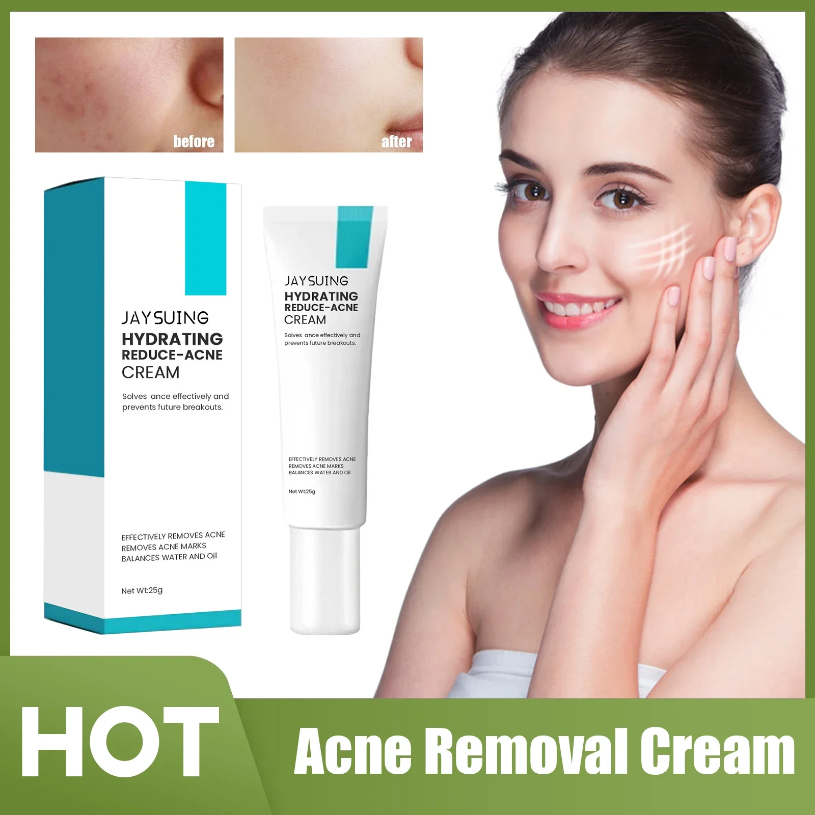 

Acne Removal Cream Clearing Pimples Scars Repair Treatment Fade Spot Eliminate Acne Marks Shrink Pores Whitening Anti-acne Cream