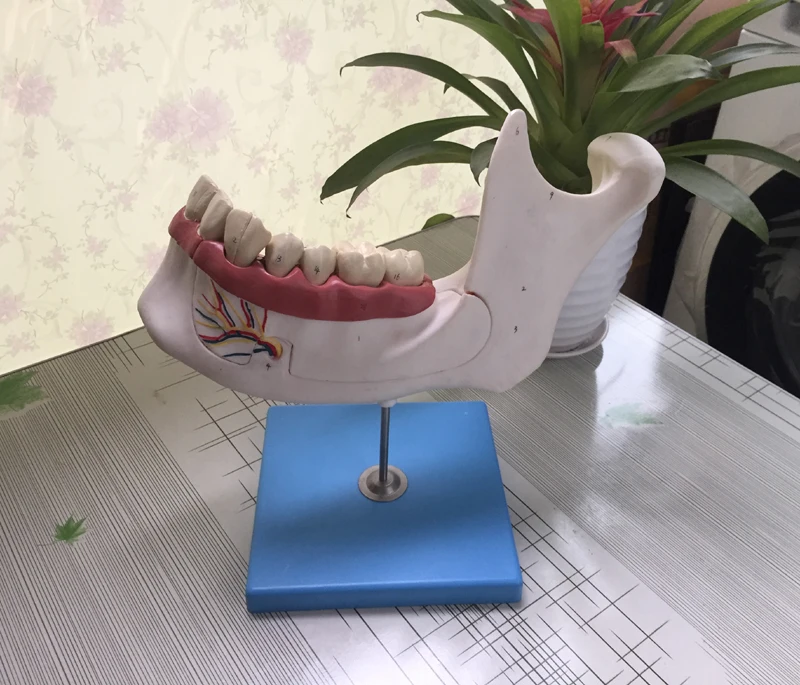 

An Enlarged Model of Adult Dentition