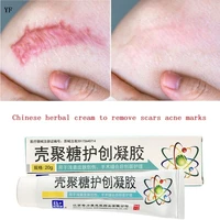 acne scar removal gel removes stretch marks surgical burn scars treatment repair chitosan smoothing body skin care 20g