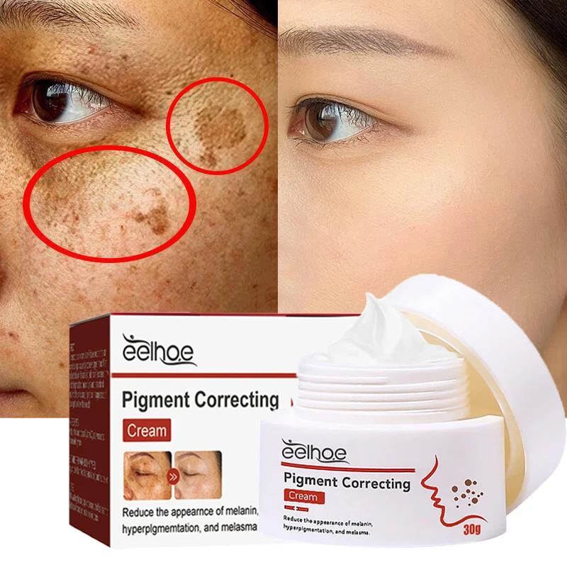 Whitening Freckle Face Cream Remove Melanin Melasma Fade Dark Spots Acne Scars Brighten Moisturizing Anti-Aging Repair Skin Care