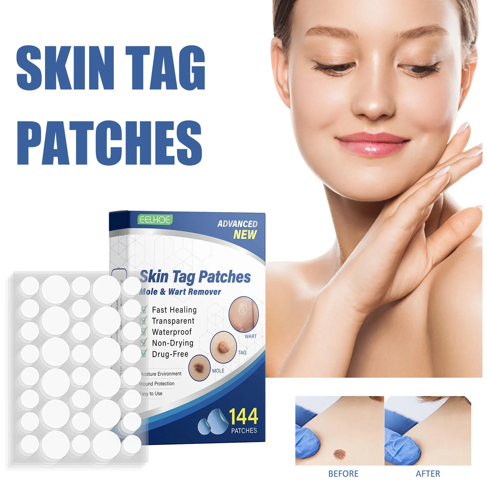 

144 шт./коробка, пластырь для удаления бородавок