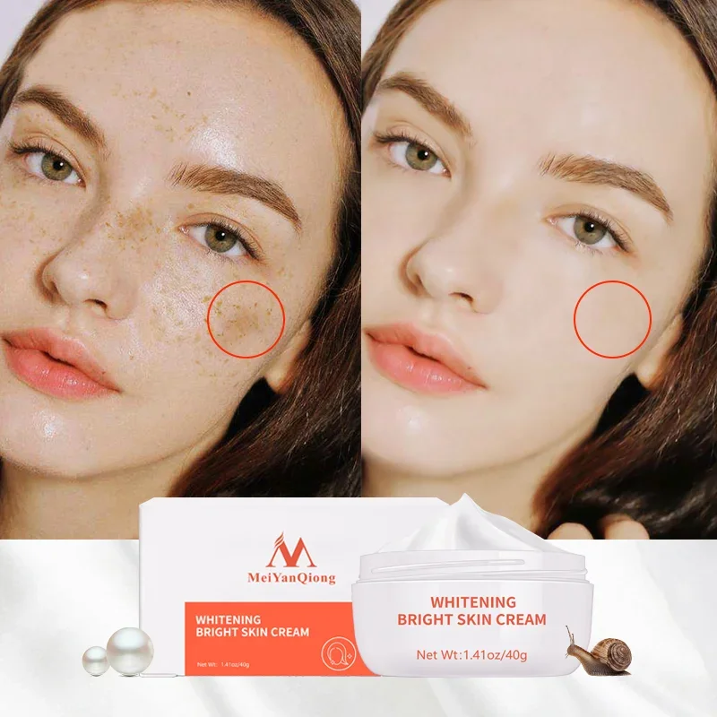 

Bright Skin Cream Powerful Whitening Freckle Cream Remove Melasma Acne Spots Pigment Melanin Dark Spots Face Care Cream skin