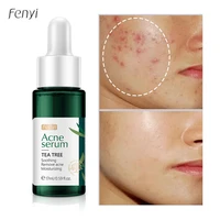 laikou tea tree acne serum remove pimples acne scar whitening acne marks dark spots oil control soothing sensitive skin care