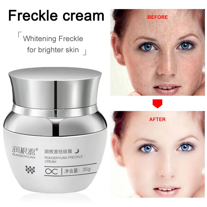 Rungenyuan whitening freckle cream Moisturizing Beauty Products Whitening Skin Cream Cosmetics for Face Care  whitening lotion