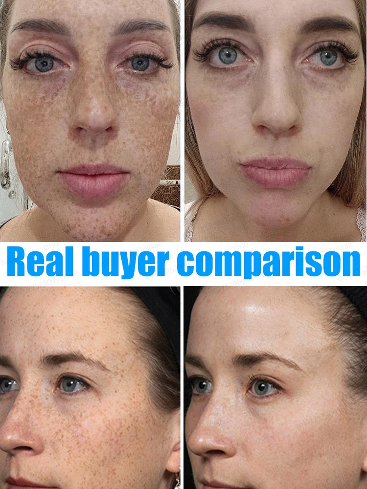 Рисунок 5 - Средство для удаления темных точек на лице