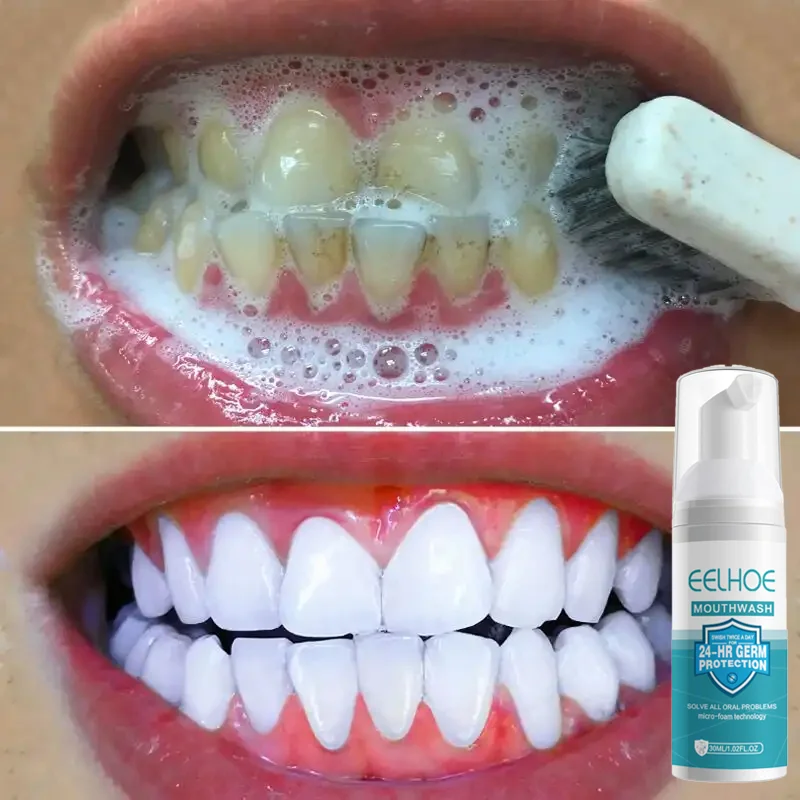 

Tooth Stain Removal Gum Bleeding Whitening Deep Cleaning Dental Plaque Oral Hygiene Products