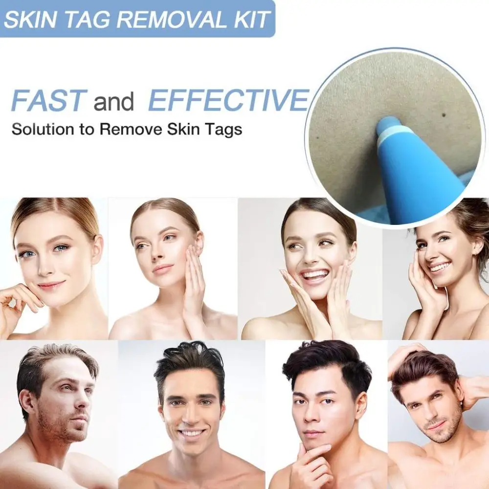 

Auto Painless Effective Non Toxic Mole Wart Tool Skin Tag Remover Skin Tag Removal Kit Body Warts Treatment