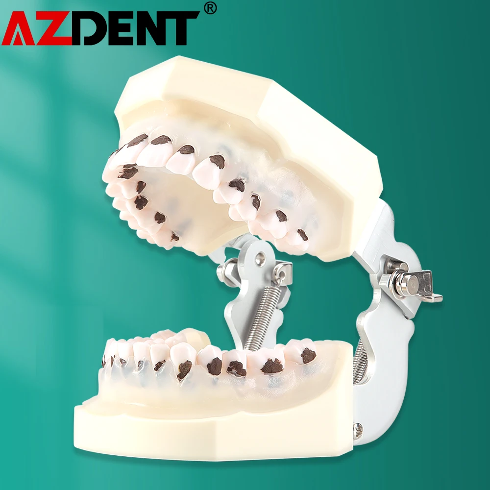 

Родное заболевание, модель модели с родственником