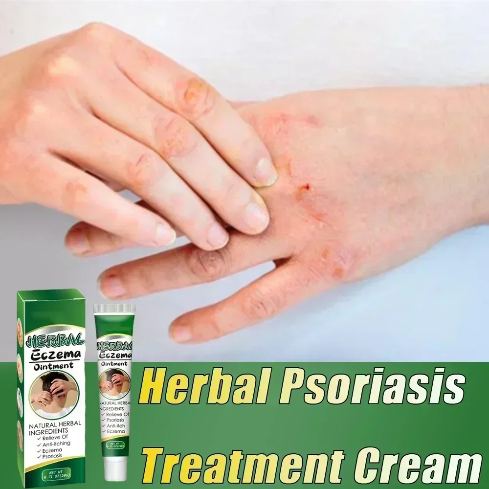 Китайская Антибактериальная мазь для кожи при псориазе Eczma Itchy Herbal