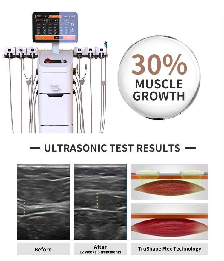 Новое поступление скульптурная машина для похудения