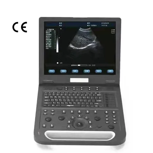 

Best Medical Equipment RS-N50 Portable Full Digital Color Doppler Ultrasound Scanner Diagnostic System ultrasound