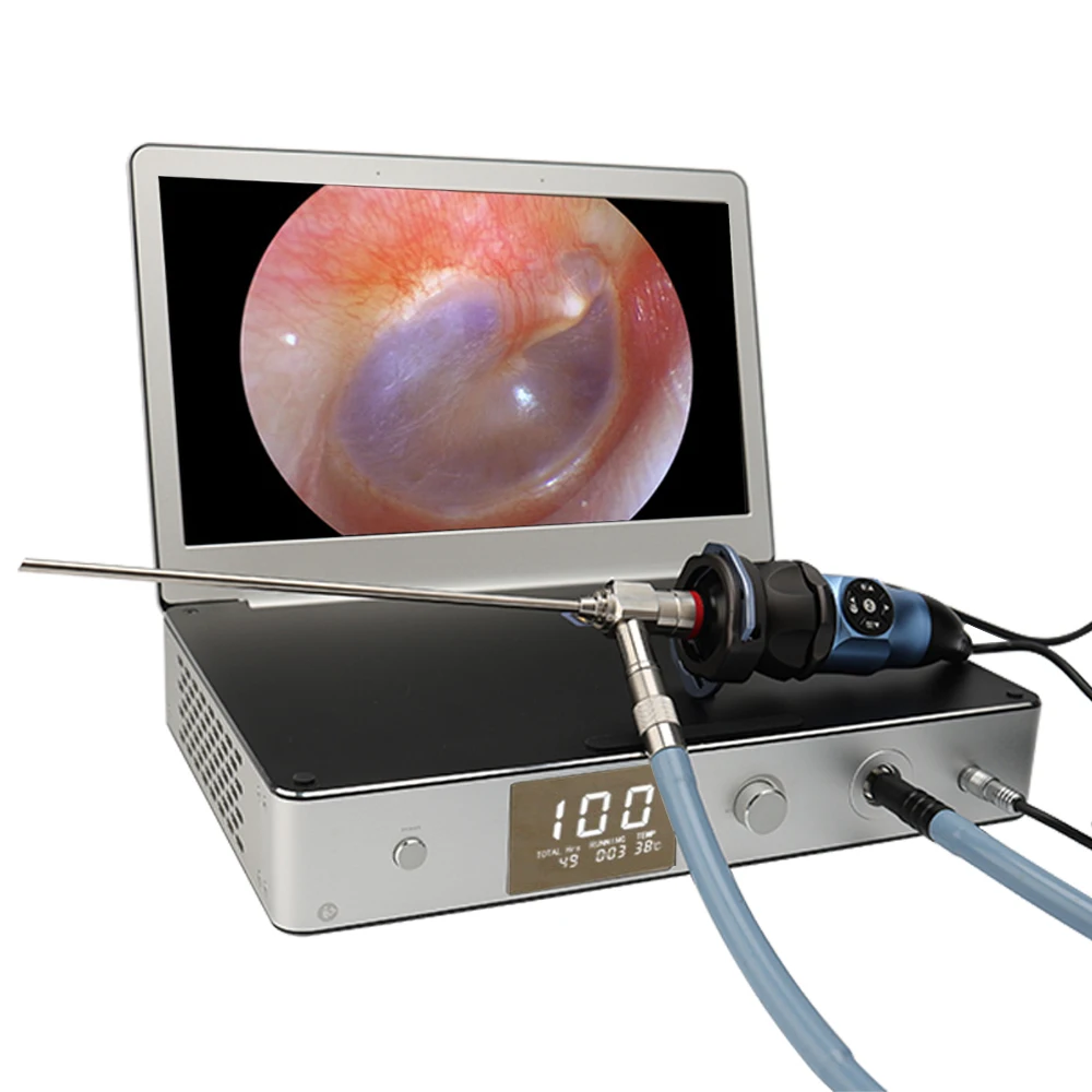 Интегрированная эндоскопическая камера USB HDMI Full HD Эндоскопическая Камера 11 6