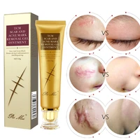 acne scar removal cream stretch marks repair treatment remove pimples spots smoothing body gel skin care 30g body cream unsex