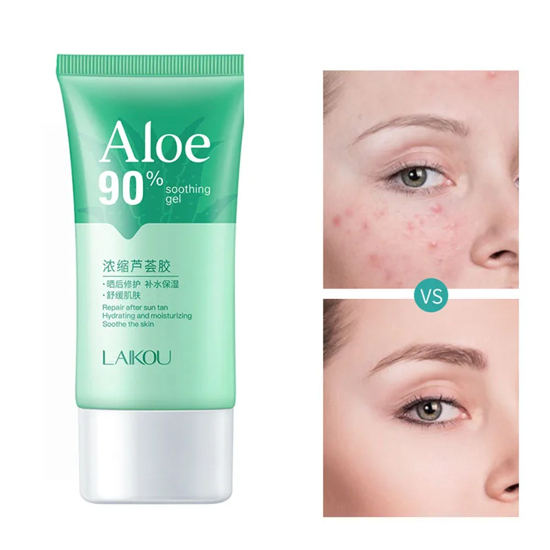 

Aloe Vera Gel Acne Treatment Protetor Solar Creme Visage Wrinkle Dark Spot Remover For Face Correcteur De Teint Emulsions Krem
