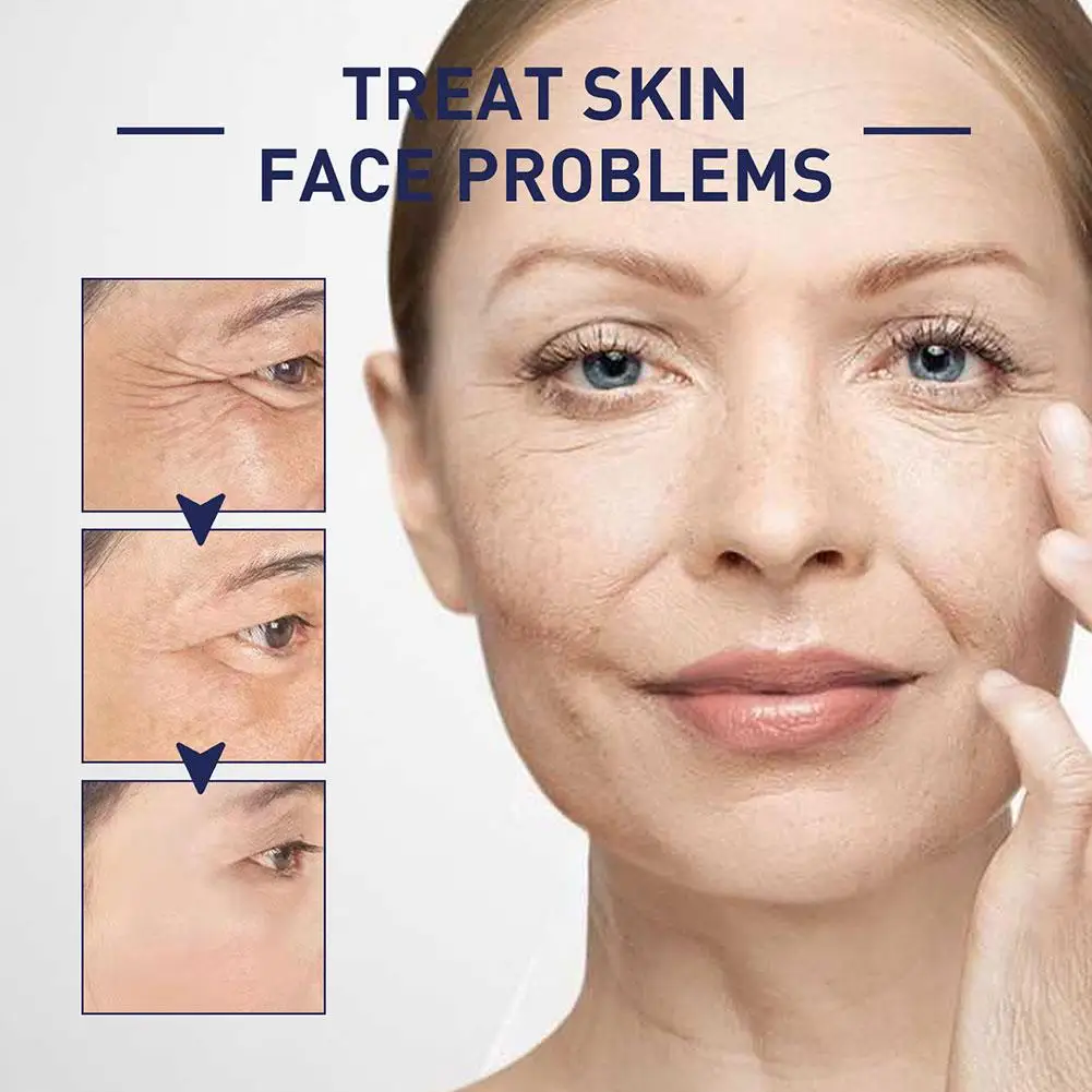 

Collagen Boosting Serum Instant Anti-Aging Reduces Fine Whitening Moisturizing Lines Wrinkles Brighten Tighten Care Fade Sk X8J1