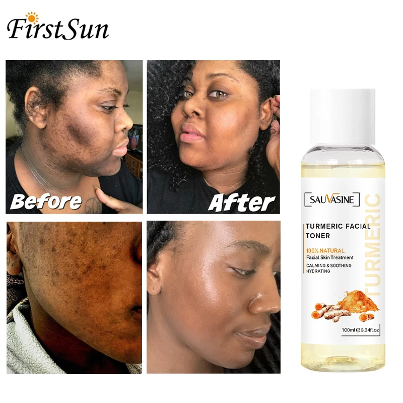 

100ml Turmeric Face Toner for Oil Skin Acne Dark Spot Removal Whitening Face Serum Moisturizing Skin Brighten Essential Liquid