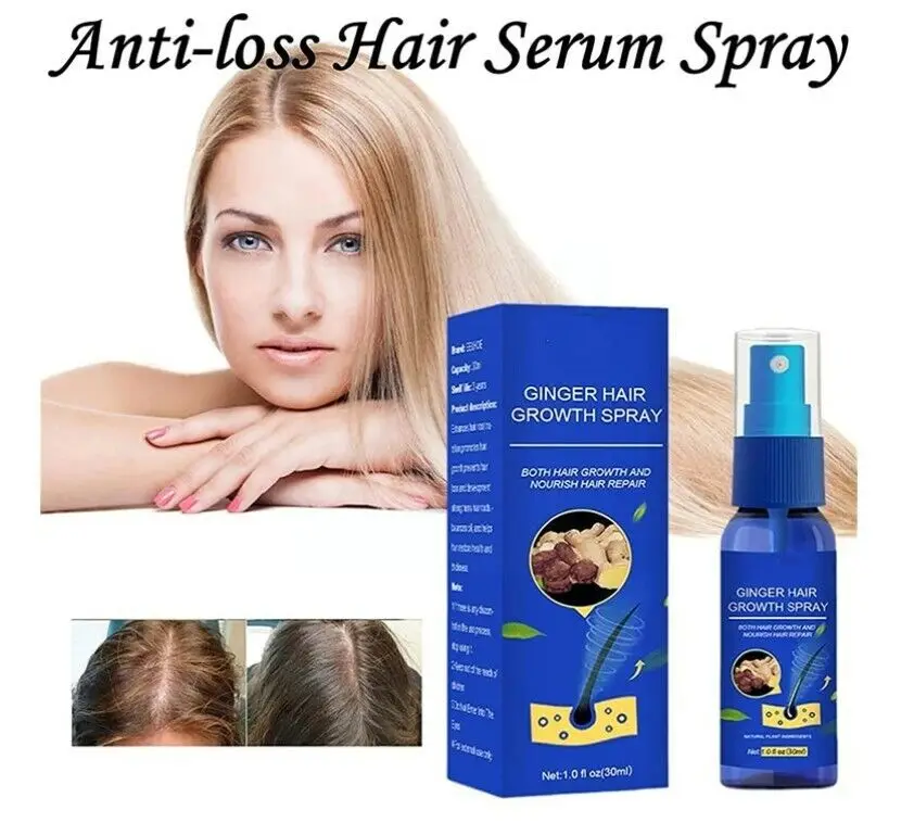 Sparkygarden Hair Growth Gingro Anti-loss Hair Serum Spray