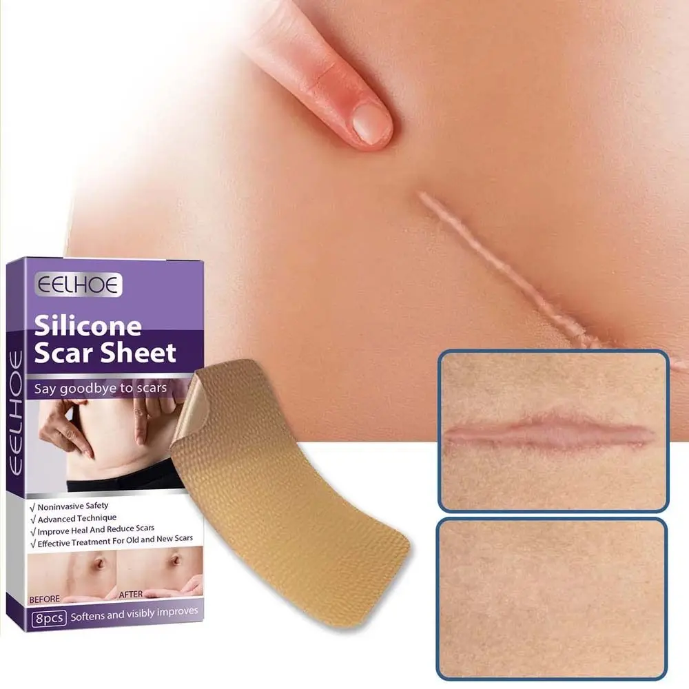 

Burn Scar Scar Skin Repair Patch Skin Repair Elastic Fabric Stretch Mark Tape Fade Scars Silicone Scar Sheets Outdoor