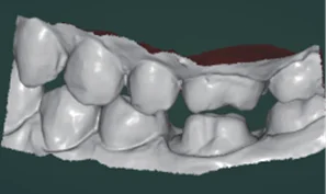 Рисунок 3 - Новый стоматологический 3D сканер