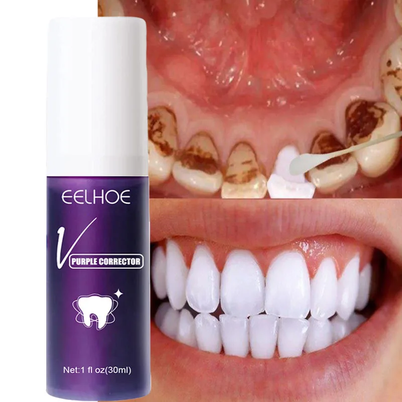 Teeth Whitening Mousse Toothpaste Dental Bleaching Deep Cleaning Removes Stains Dentistry Tool Fresh Breath Oral Hygiene Product