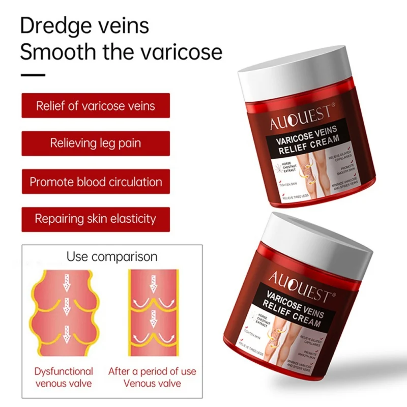 

80g Varicose Veins Pain Relief Body Creams Leg Improve Blood Circulation Soothe Tired Spider Tighten Smooth Beauty Health Care