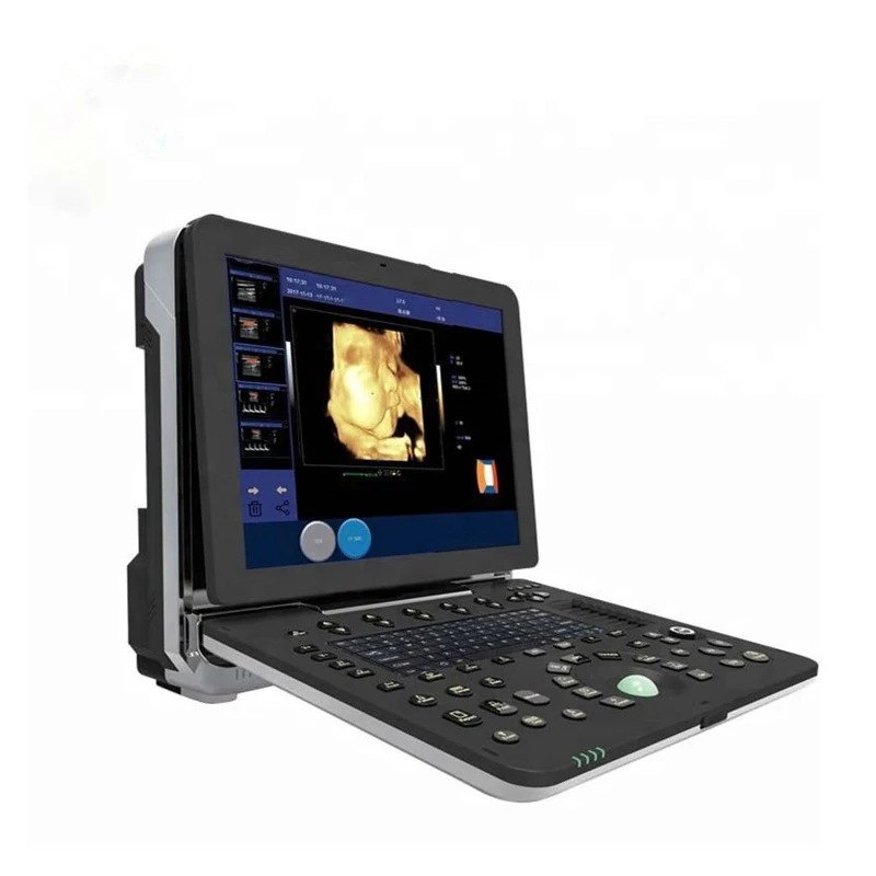 

Anesthesia Cardiac Ultrasound Portable 4d Color doppler Ultrasound Machine High end Ultrasound Equipment